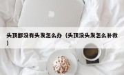 头顶都没有头发怎么办（头顶没头发怎么补救）